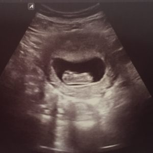 8 week scan of Baby Bryce. 